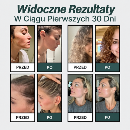Vivora™ — Głowica Prysznicowa z Potrójną Filtracją · Usuwa Chlor, Kamień i Metale Ciężkie